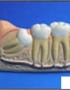 Anatomy model - teeth
