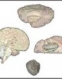 Anatomy model - human brain